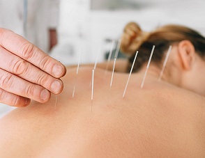 acupuncture for addiction treatment scaled 1